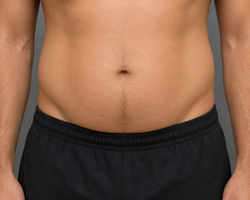 Belly Fat.webp